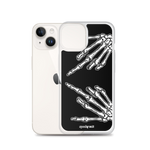 F-U Skeleton iPhone Case (Black)